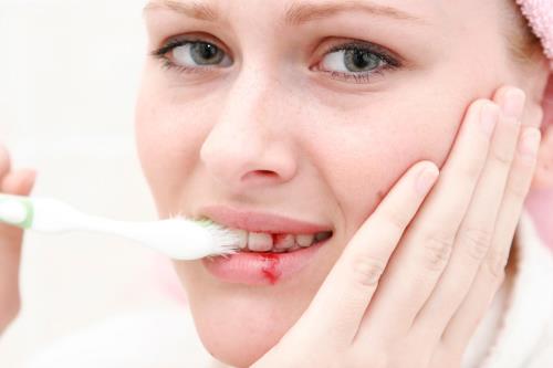 Vệ sinh răng miệng kém có thể gây nên chảy máu chân răng